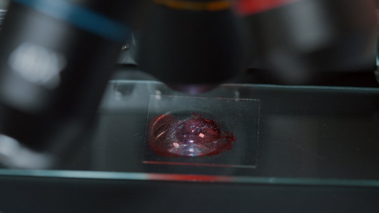Microscopio ottico con un vetrino avente una goccia di sangue